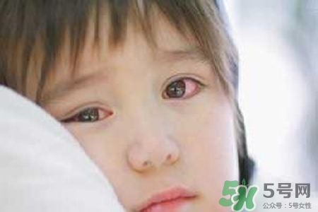 孩子為什么老眨眼睛？孩子總眨眼睛怎么回事？