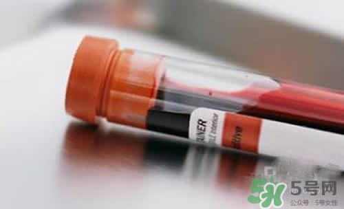 孩子沒出生可以做親子鑒定嗎？孩子沒出生怎么做親子鑒定？