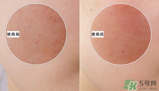 holika懶蛋蛋去角質(zhì)多少錢？holika雞蛋去角質(zhì)啫喱價格