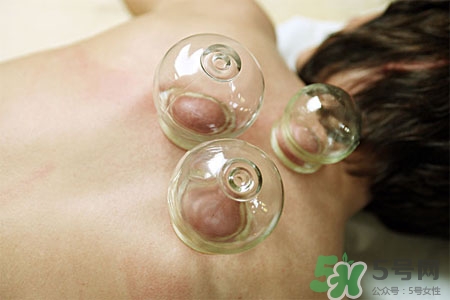 拔罐減肥為什么會反彈？拔罐減肥后不反彈的方法