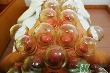 拔罐減肥為什么會反彈？拔罐減肥后不反彈的方法