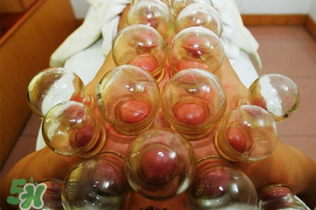 拔罐后皮膚發(fā)癢是怎么回事？拔罐后為什么皮膚會(huì)癢？