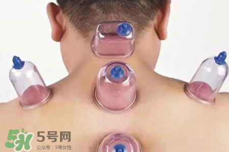 拔罐后可以喝酒嗎？拔罐后多久能喝酒？