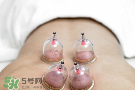 拔罐后可以泡澡嗎？拔罐后多久能泡澡？