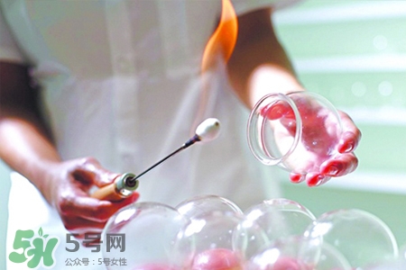 拔罐后可以泡澡嗎？拔罐后多久能泡澡？