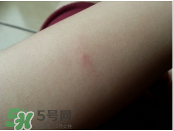 理膚泉b5修復(fù)霜怎么樣？理膚泉b5可以天天用嗎？