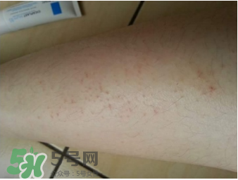 理膚泉b5修復(fù)霜怎么樣？理膚泉b5可以天天用嗎？