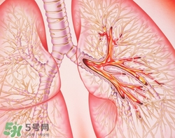 支氣管炎吃什么藥有效?支氣管炎如何根治 支氣管炎吃什么藥有效?支氣管炎如何根治