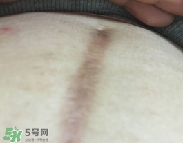 百洛護膚油怎么用?百洛護膚油使用方法 百洛護膚油怎么用?百洛護膚油使用方法