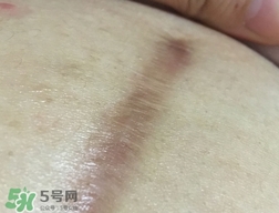 百洛護膚油怎么用?百洛護膚油使用方法 百洛護膚油怎么用?百洛護膚油使用方法