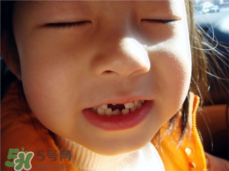 孩子換牙乳牙不掉怎么辦?換牙可以拔掉嗎? 孩子換牙乳牙不掉怎么辦?換牙可以拔掉嗎?