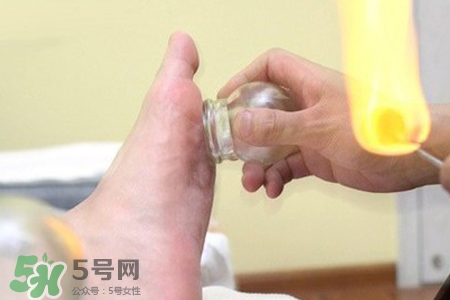 冬天拔火罐能減肥嗎？拔火罐什么季節(jié)減肥效果最好？