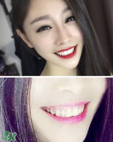 碧緹福冷光牙齒美白儀怎么用？碧緹福冷光牙齒美白儀使用方法