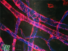 人造血管可以用多久?人造血管的護(hù)理 人造血管可以用多久?人造血管的護(hù)理