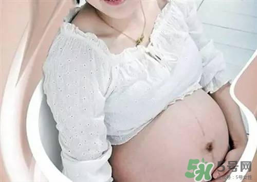 孕婦肚子上的黑線能看出生男生女嗎? 孕婦肚子上的黑線能看出生男生女嗎?