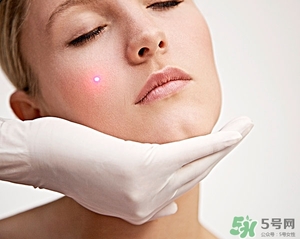 針清痘痘真的能好嗎?針清痘痘后幾天能好? 針清痘痘真的能好嗎?針清痘痘后幾天能好?