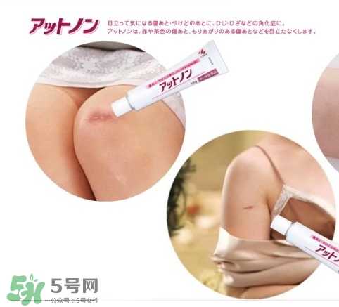 小林制藥去疤膏怎么用？小林制藥去疤膏說明書