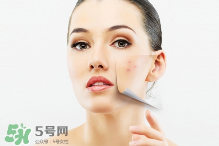 祛痘產(chǎn)品排行榜10強(qiáng) 2017祛痘小妙招 祛痘產(chǎn)品排行榜10強(qiáng) 2017祛痘小妙招