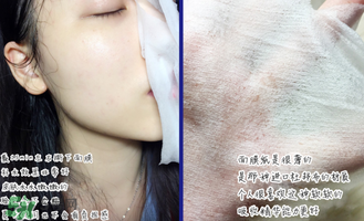 稚優(yōu)泉面膜怎么用？稚優(yōu)泉面膜要洗嗎？