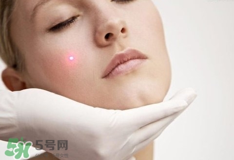 激光祛斑后吃什么才能恢復(fù)快點(diǎn)?激光祛斑后吃什么好? 激光祛斑后吃什么才能恢復(fù)快點(diǎn)?激光祛斑后吃什么好?