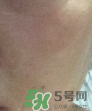 skin1004是什么牌子？skin1004屬于什么檔次