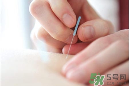 腰間盤(pán)突出可以針灸嗎？針灸能治腰間盤(pán)突出嗎？