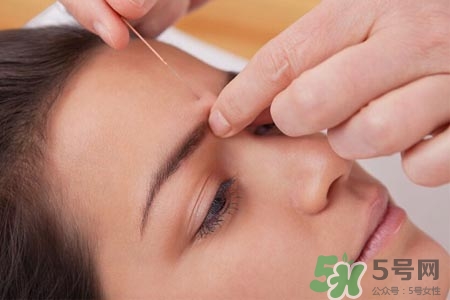 腰間盤(pán)突出可以針灸嗎？針灸能治腰間盤(pán)突出嗎？