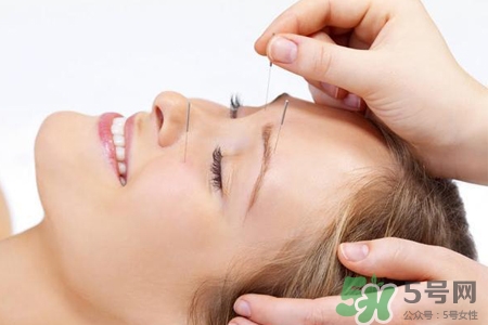 腰間盤(pán)突出可以針灸嗎？針灸能治腰間盤(pán)突出嗎？