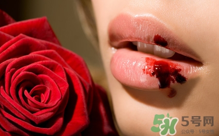 嘴唇干裂出血是什么原因?嘴唇干裂出血是怎么回事? 嘴唇干裂出血是什么原因?嘴唇干裂出血是怎么回事?