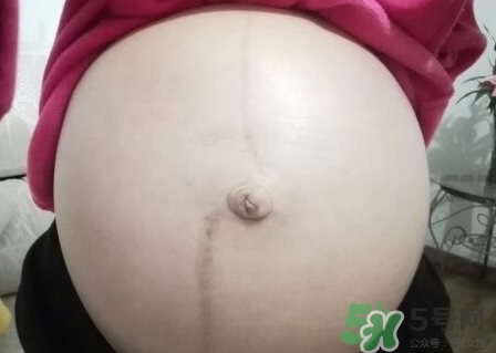懷孕5個月肚臍眼癢是怎么回事?是什么原因? 懷孕5個月肚臍眼癢是怎么回事?是什么原因?