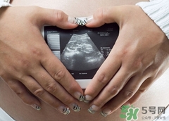 老婆明天總沒有看b超吧是什么意思? 老婆明天總沒有看b超吧是什么意思?