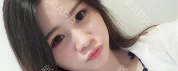 定點雙眼皮能保持多久？定點雙眼皮是永久的嗎？