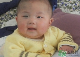 新生兒身上有青塊是怎么回事?是什么原因? 新生兒身上有青塊是怎么回事?是什么原因?