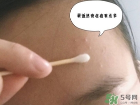 星期四農莊茶樹精油怎么用？星期四農莊茶樹精油使用方法