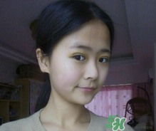 埋線雙眼皮需要拆線嗎？埋線雙眼皮怎么拆線