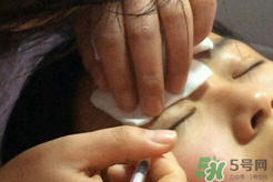 埋線雙眼皮需要拆線嗎？埋線雙眼皮怎么拆線