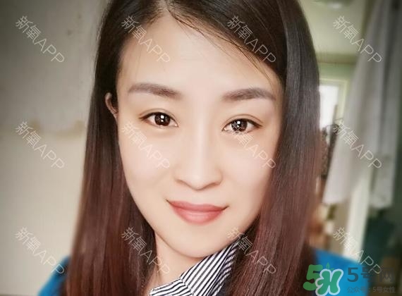 埋線(xiàn)雙眼皮能保持多久？埋線(xiàn)雙眼皮是永久嗎