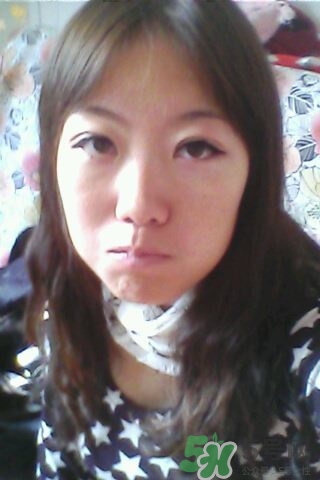 什么是定點(diǎn)雙眼皮？定點(diǎn)雙眼皮多少錢？