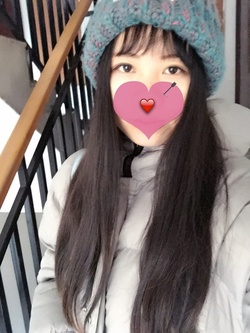 定點(diǎn)雙眼皮恢復(fù)過(guò)程圖_定點(diǎn)雙眼皮要多久恢復(fù) 定點(diǎn)雙眼皮恢復(fù)過(guò)程圖_定點(diǎn)雙眼皮要多久恢復(fù)