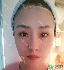 埋線(xiàn)雙眼皮能保持多久？埋線(xiàn)雙眼皮是永久嗎