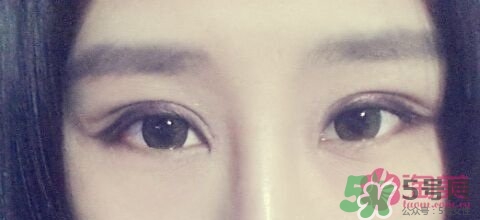 切開雙眼皮多久消腫？切開雙眼皮多久恢復(fù)？