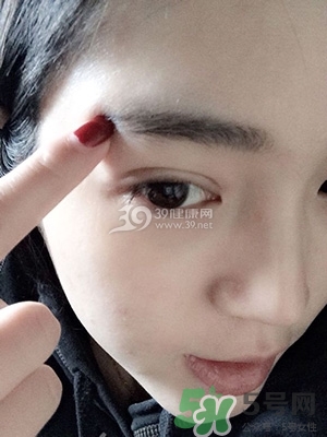 什么是定點(diǎn)雙眼皮？定點(diǎn)雙眼皮多少錢？