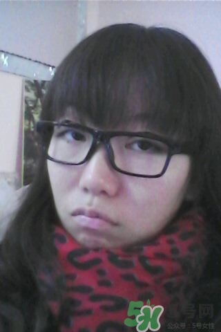 什么是定點(diǎn)雙眼皮？定點(diǎn)雙眼皮多少錢？