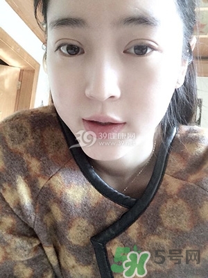 什么是定點(diǎn)雙眼皮？定點(diǎn)雙眼皮多少錢？