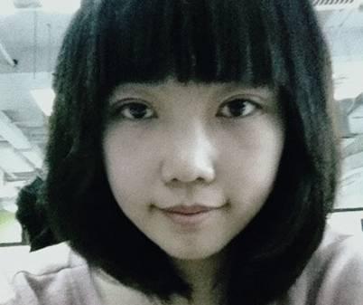 韓式三點(diǎn)雙眼皮是永久嗎？三點(diǎn)雙眼皮能保持多久？