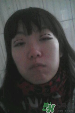 什么是定點(diǎn)雙眼皮？定點(diǎn)雙眼皮多少錢？