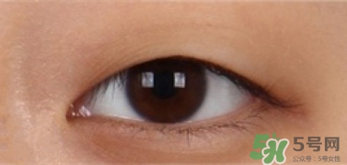 埋線雙眼皮多久恢復(fù)自然？埋線雙眼皮多久能恢復(fù)