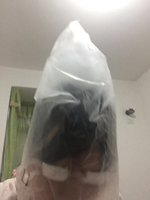 定點(diǎn)雙眼皮恢復(fù)過(guò)程圖_定點(diǎn)雙眼皮要多久恢復(fù) 定點(diǎn)雙眼皮恢復(fù)過(guò)程圖_定點(diǎn)雙眼皮要多久恢復(fù)