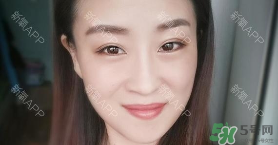 埋線(xiàn)雙眼皮能保持多久？埋線(xiàn)雙眼皮是永久嗎