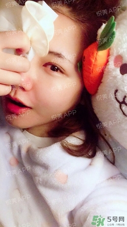 定點雙眼皮恢復過程圖_定點雙眼皮要多久恢復 定點雙眼皮恢復過程圖_定點雙眼皮要多久恢復